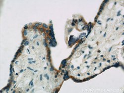 ACSL4/FACL4 Rabbit anti-Human, Polyclonal, Proteintech 150 &mu;L; Unconjugated:Antibodies,