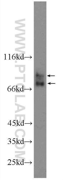 ACSL4/FACL4 Rabbit anti-Human, Polyclonal, Proteintech 150 &mu;L; Unconjugated:Antibodies,