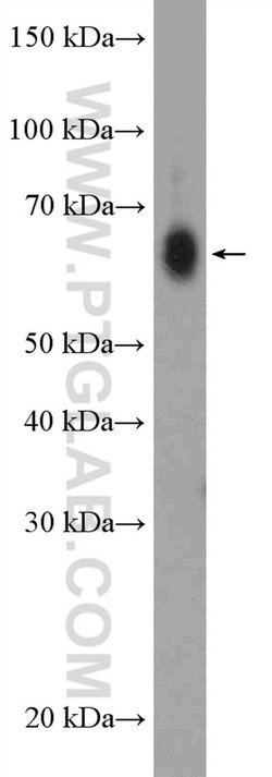 ZCCHC7 Rabbit anti-Human, Polyclonal, Proteintech 150 &mu;L; Unconjugated:Antibodies,