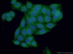 Casein Kinase 2 beta Rabbit anti-Human, Mouse, Polyclonal, Proteintech