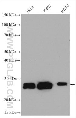 Casein Kinase 2 beta Rabbit anti-Human, Mouse, Polyclonal, Proteintech