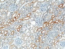ABLIM2 Rabbit anti-Human, Mouse, Rat, Polyclonal, Proteintech:Antibodies:Primary