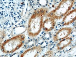 ABLIM2 Rabbit anti-Human, Mouse, Rat, Polyclonal, Proteintech:Antibodies:Primary
