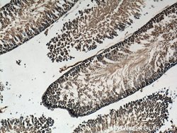 GNRHR Rabbit anti-Human, Mouse, Rat, Polyclonal, Proteintech:Antibodies:Primary