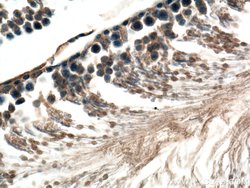 GNRHR Rabbit anti-Human, Mouse, Rat, Polyclonal, Proteintech:Antibodies:Primary