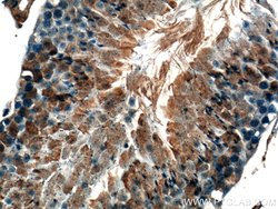 GNRHR Rabbit anti-Human, Mouse, Rat, Polyclonal, Proteintech:Antibodies:Primary