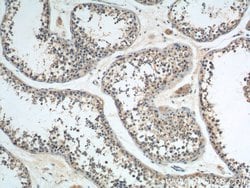 GNRHR Rabbit anti-Human, Mouse, Rat, Polyclonal, Proteintech:Antibodies:Primary