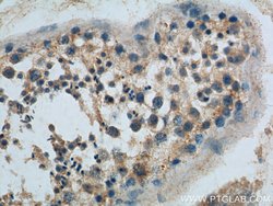 GNRHR Rabbit anti-Human, Mouse, Rat, Polyclonal, Proteintech:Antibodies:Primary