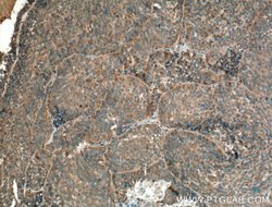 GNRHR Rabbit anti-Human, Mouse, Rat, Polyclonal, Proteintech:Antibodies:Primary