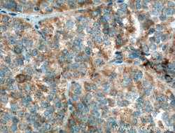 GNRHR Rabbit anti-Human, Mouse, Rat, Polyclonal, Proteintech:Antibodies:Primary
