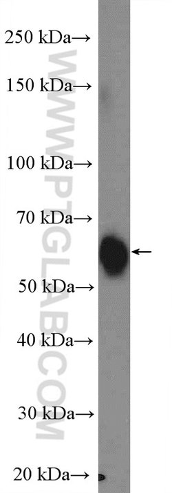 GNRHR Rabbit anti-Human, Mouse, Rat, Polyclonal, Proteintech:Antibodies:Primary
