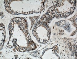 GNRHR Rabbit anti-Human, Mouse, Rat, Polyclonal, Proteintech:Antibodies:Primary