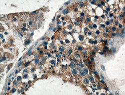 GNRHR Rabbit anti-Human, Mouse, Rat, Polyclonal, Proteintech:Antibodies:Primary