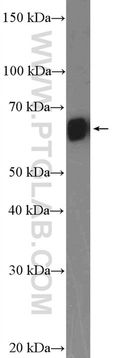 GNRHR Rabbit anti-Human, Mouse, Rat, Polyclonal, Proteintech:Antibodies:Primary