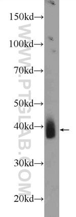 Thumbnail_NKX3-2 Rabbit anti-Human, Mouse, Polyclonal, Proteintech 20 &mu;L; Unconjugated:Anticorps,