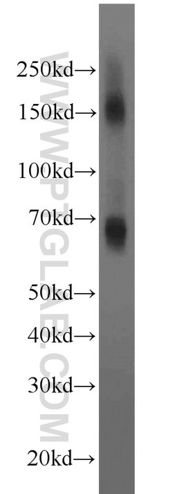 EAAT2 Rabbit anti-Human, Mouse, Rat, Polyclonal, Proteintech 20 &mu;L;