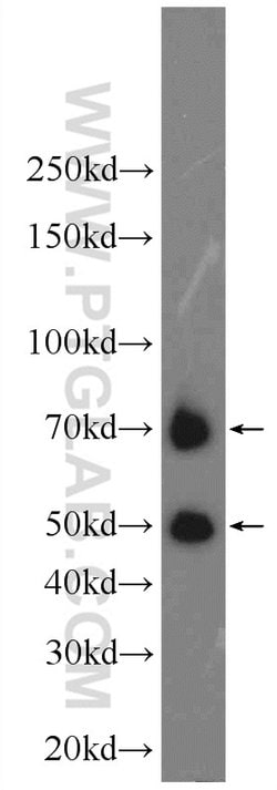 AIRE Rabbit anti-Human, Mouse, Polyclonal, Proteintech 150 &mu;L; Unconjugated:Antibodies,