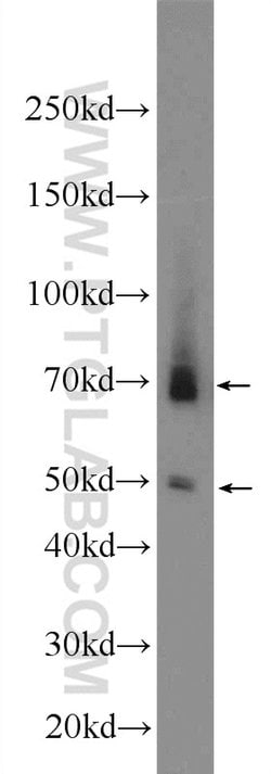 AIRE Rabbit anti-Human, Mouse, Polyclonal, Proteintech 150 &mu;L; Unconjugated:Antibodies,