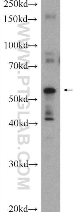 ABHD15 Rabbit anti-Human, Mouse, Polyclonal, Proteintech 150 &mu;L; Unconjugated:Antibodies,