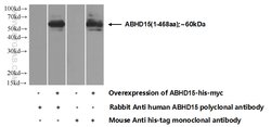ABHD15 Rabbit anti-Human, Mouse, Polyclonal, Proteintech 150 &mu;L; Unconjugated:Antibodies,