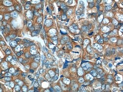 GAB2 Rabbit anti-Human, Mouse, Polyclonal, Proteintech 20 &mu;L; Unconjugated:Antibodies,