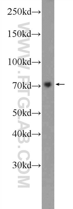 GAB2 Rabbit anti-Human, Mouse, Polyclonal, Proteintech 20 &mu;L; Unconjugated:Antibodies,