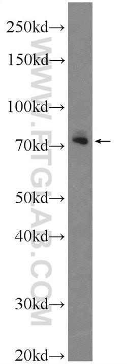 GAB2 Rabbit anti-Human, Mouse, Polyclonal, Proteintech 20 &mu;L; Unconjugated:Antibodies,