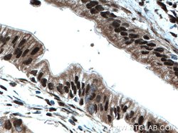 ELF1 Rabbit anti-Human, Mouse, Polyclonal, Proteintech:Antibodies:Primary