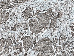 ELF1 Rabbit anti-Human, Mouse, Polyclonal, Proteintech:Antibodies:Primary