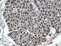 ELF1 Rabbit anti-Human, Mouse, Polyclonal, Proteintech:Antibodies:Primary
