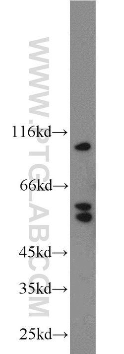 PRICKLE1 Rabbit anti-Human, Mouse, Polyclonal, Proteintech:Antibodies:Primary