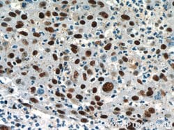 CCAR2 Rabbit anti-Human, Mouse, Rat, Polyclonal, Proteintech 150 &mu;L;