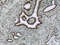 CCAR2 Rabbit anti-Human, Mouse, Rat, Polyclonal, Proteintech 150 &mu;L;
