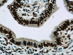 CCAR2 Rabbit anti-Human, Mouse, Rat, Polyclonal, Proteintech 150 &mu;L;