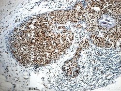 CCAR2 Rabbit anti-Human, Mouse, Rat, Polyclonal, Proteintech 150 &mu;L;