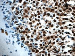 CCAR2 Rabbit anti-Human, Mouse, Rat, Polyclonal, Proteintech 150 &mu;L;