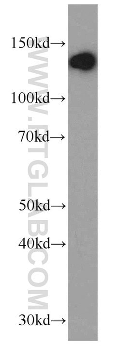 CCAR2 Rabbit anti-Human, Mouse, Rat, Polyclonal, Proteintech 150 &mu;L;