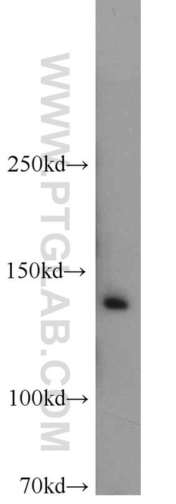 CCAR2 Rabbit anti-Human, Mouse, Rat, Polyclonal, Proteintech 150 &mu;L;