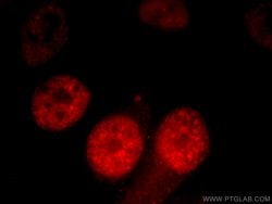 CCAR2 Rabbit anti-Human, Mouse, Rat, Polyclonal, Proteintech 150 &mu;L;