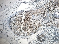 CCAR2 Rabbit anti-Human, Mouse, Rat, Polyclonal, Proteintech 150 &mu;L;