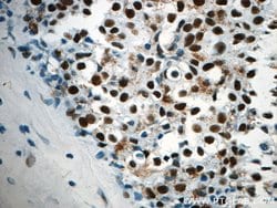 CCAR2 Rabbit anti-Human, Mouse, Rat, Polyclonal, Proteintech 150 &mu;L;