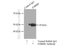 ESRRB Rabbit anti-Human, Mouse, Rat, Polyclonal, Proteintech:Anticorps:Anticorps