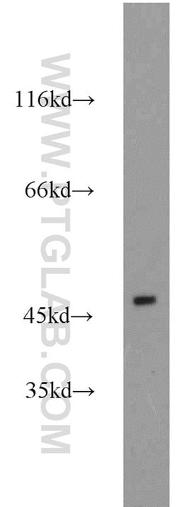 ESRRB Rabbit anti-Human, Mouse, Rat, Polyclonal, Proteintech:Anticorps:Anticorps