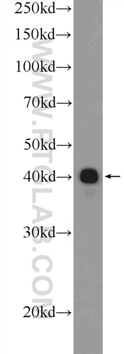 ESRRB Rabbit anti-Human, Mouse, Rat, Polyclonal, Proteintech