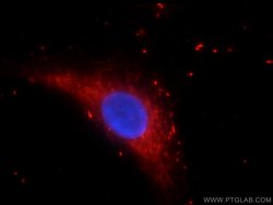 DNASE2B Rabbit anti-Human, Polyclonal, Proteintech:Antibodies:Primary Antibodies