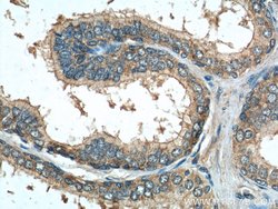 DNASE2B Rabbit anti-Human, Polyclonal, Proteintech:Antibodies:Primary Antibodies