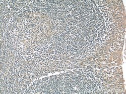 DNASE2B Rabbit anti-Human, Polyclonal, Proteintech:Antibodies:Primary Antibodies