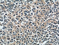 DNASE2B Rabbit anti-Human, Polyclonal, Proteintech:Antibodies:Primary Antibodies