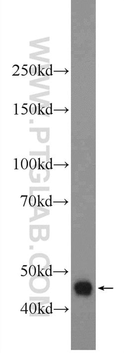 DNASE2B Rabbit anti-Human, Polyclonal, Proteintech:Antibodies:Primary Antibodies