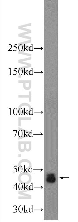 DNASE2B Rabbit anti-Human, Polyclonal, Proteintech:Antibodies:Primary Antibodies